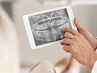 Tablet with digital dental x-rays