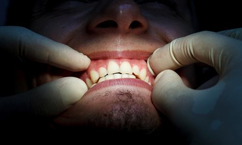 man receiving gum disease treatment