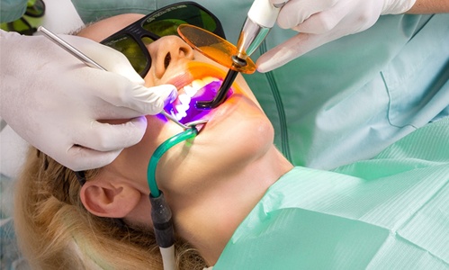 A dentist using a curing light on a patient