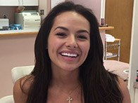 Young woman with beautiful straight teeth